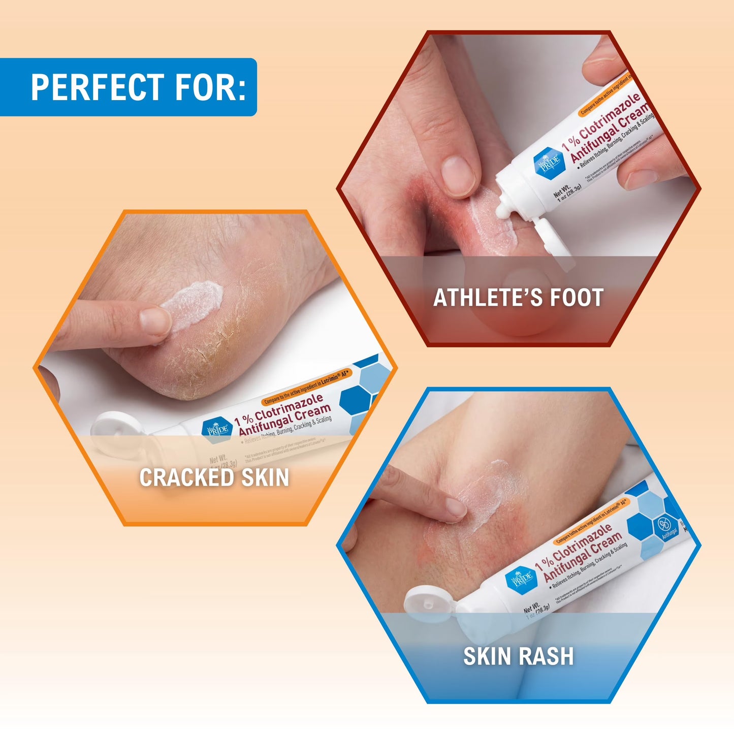 (2 Pack) MED PRIDE Antifungal Cream 1% Clotrimazole – Antifungal Ointment for Jock Itch, Athlete’S Foot & Ringworm, Foot Fungus Treatment Relieves Itching 1Oz