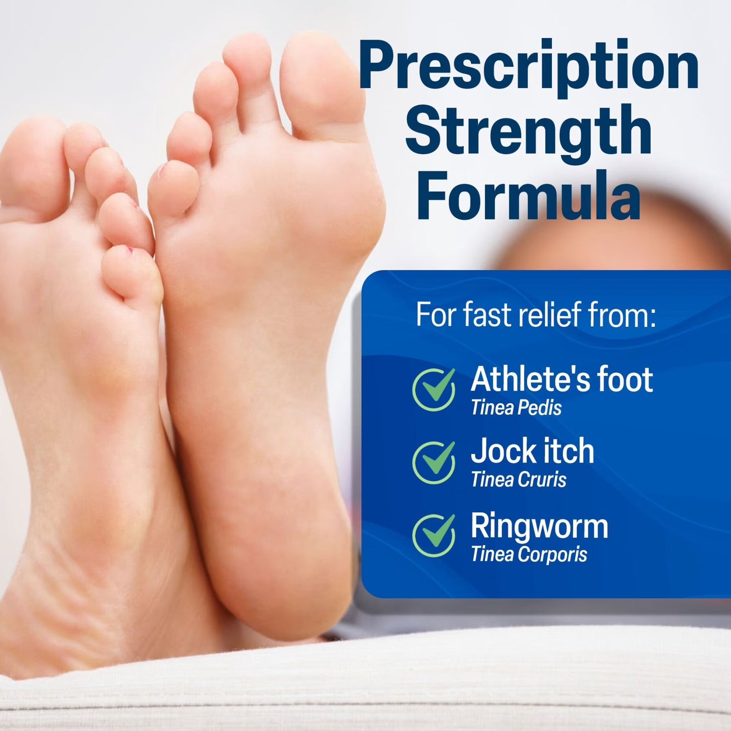 Terbinafine Hydrochloride 1% Athletes Foot Treatment, Antifungal Cream for Skin, Effective anti Fungal Cream for Athlete'S Foot Relief and Skin Health, 1 Oz Tube