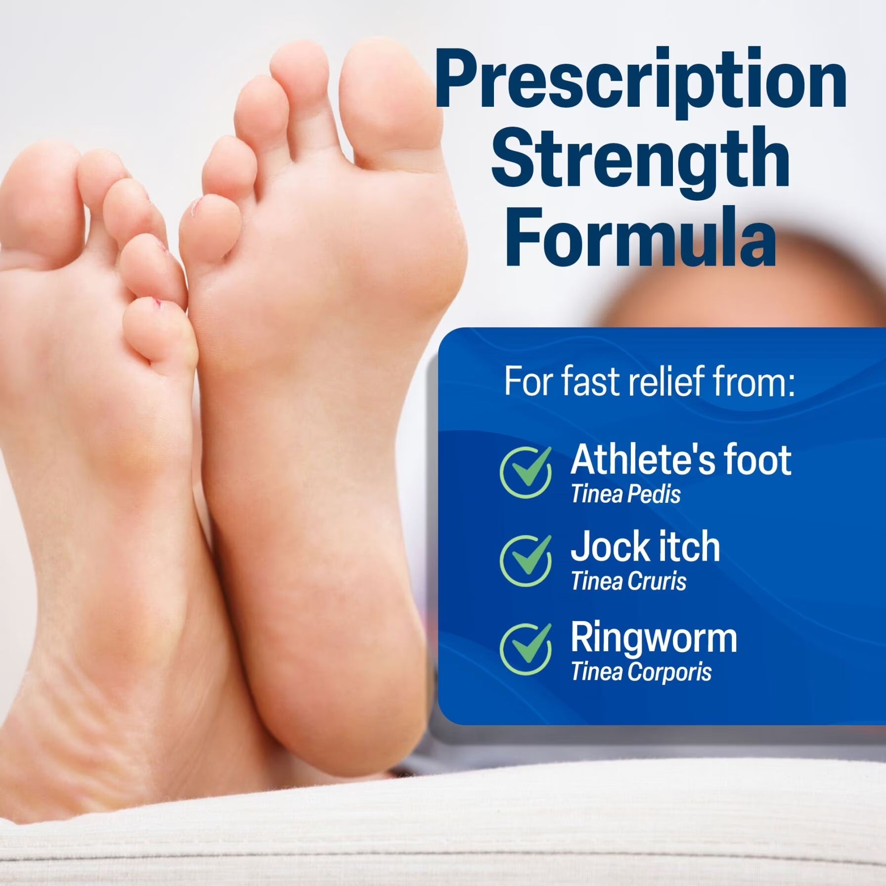 Terbinafine Hydrochloride 1% Athletes Foot Treatment, Antifungal Cream for Skin, Effective anti Fungal Cream for Athlete'S Foot Relief and Skin Health, 1 Oz Tube